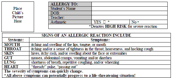 Allergies to: